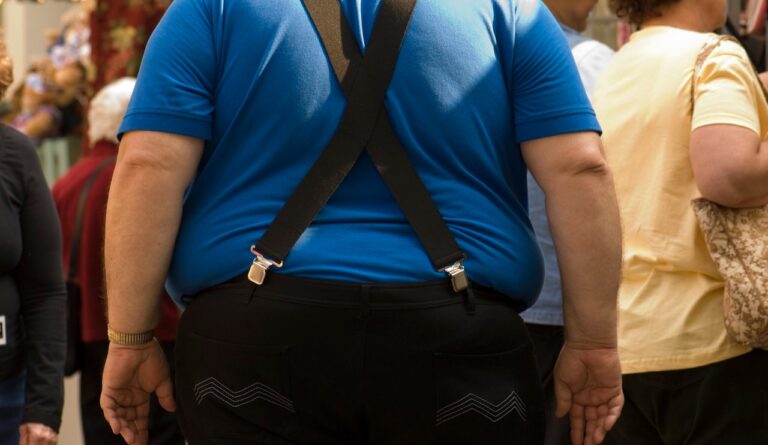 obese man walking